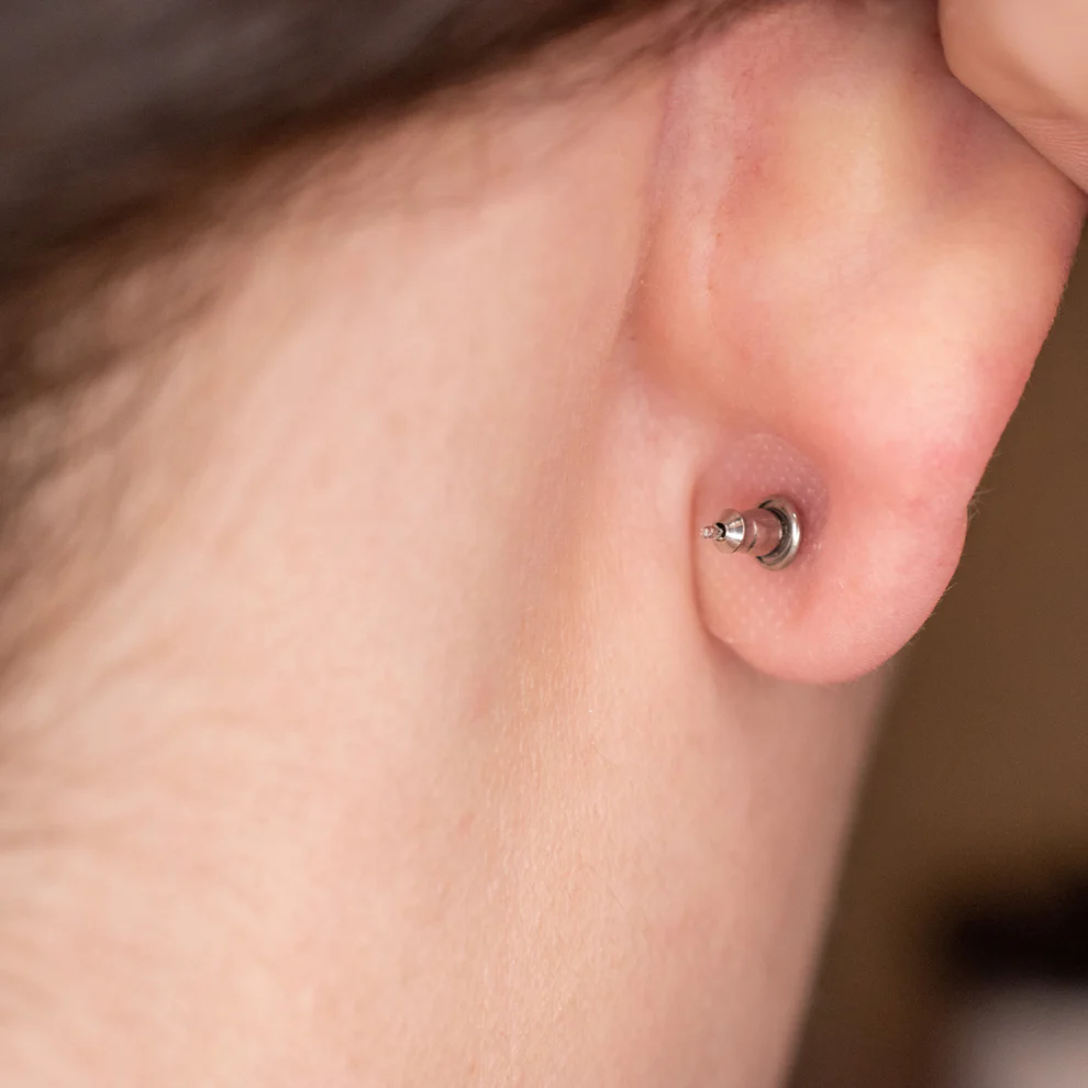 Invisible Ear Patch applied behind the earlobe to support heavy earrings and prevent earlobe stretching.